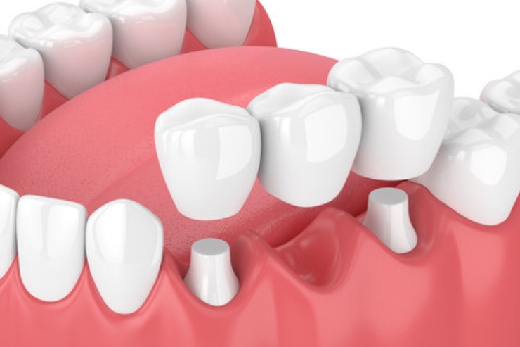 v v dental