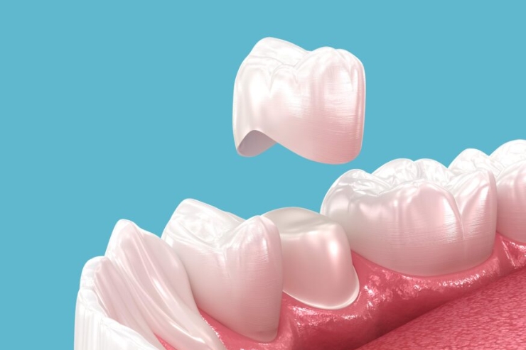 v v dental