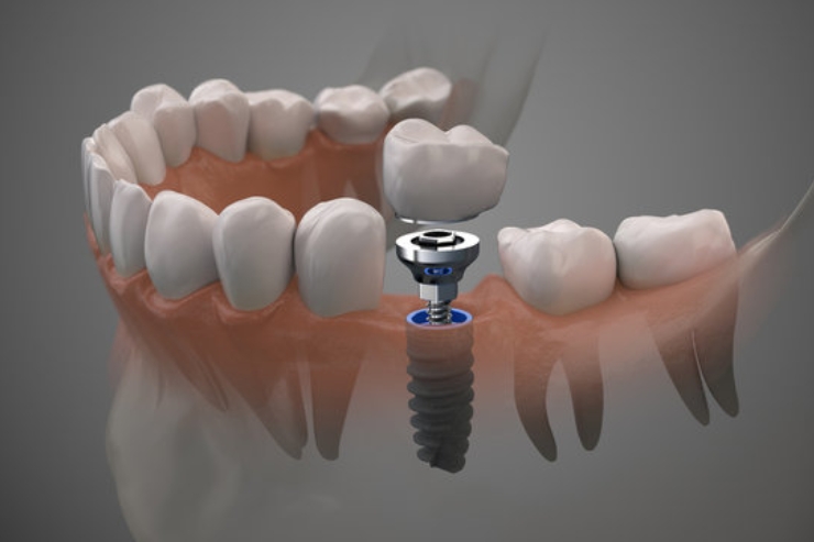 v v dental