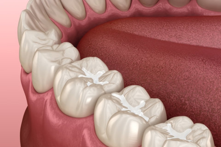 v v dental