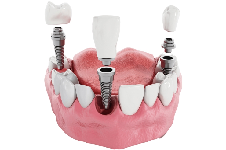 v v dental