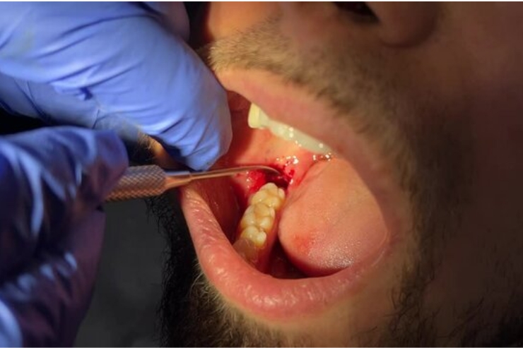 v v dental