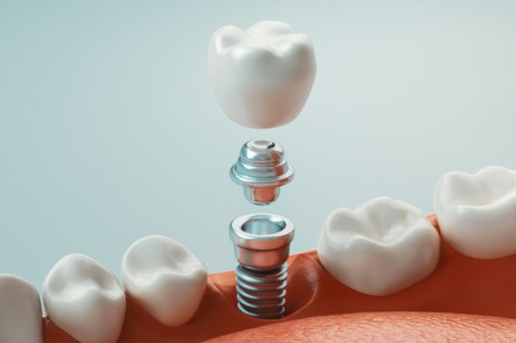 v v dental